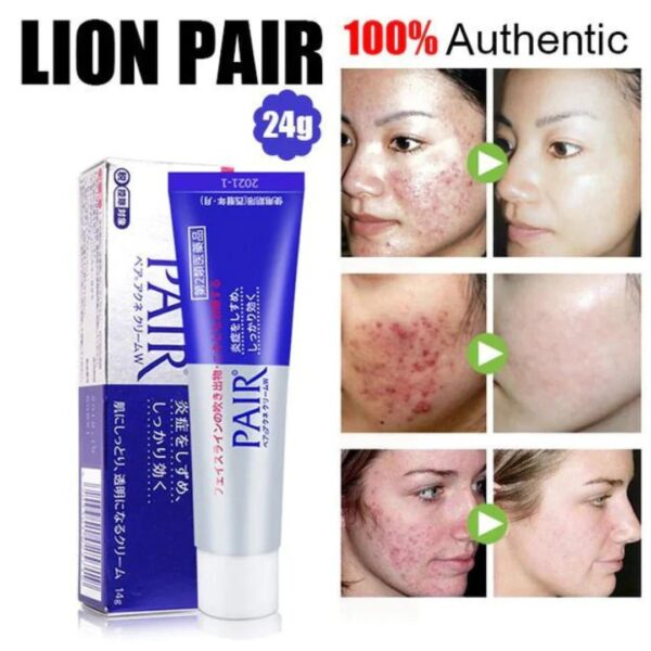 Pair Acne Cream W - Зображення 2