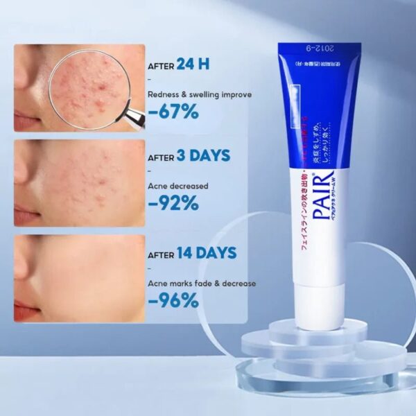 Pair Acne Cream W - Зображення 3