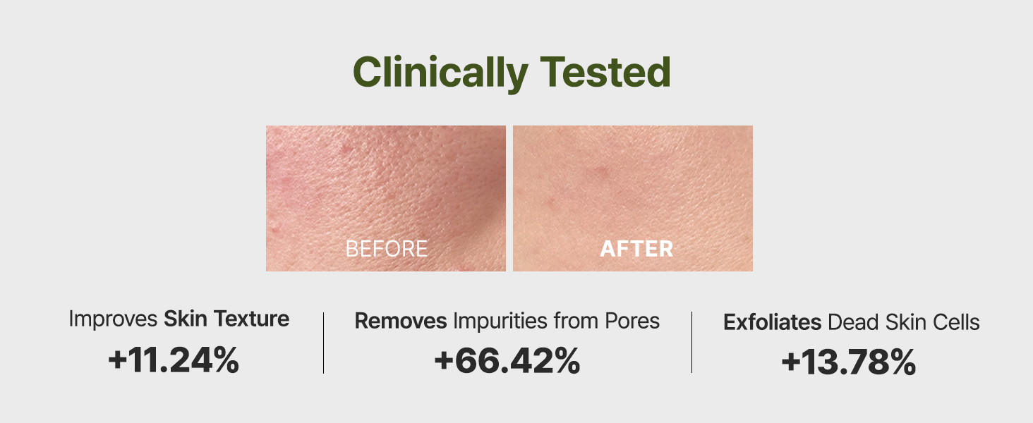 Green Tea + LHA Deep Pore Rice Cake Cleanser - Зображення 8