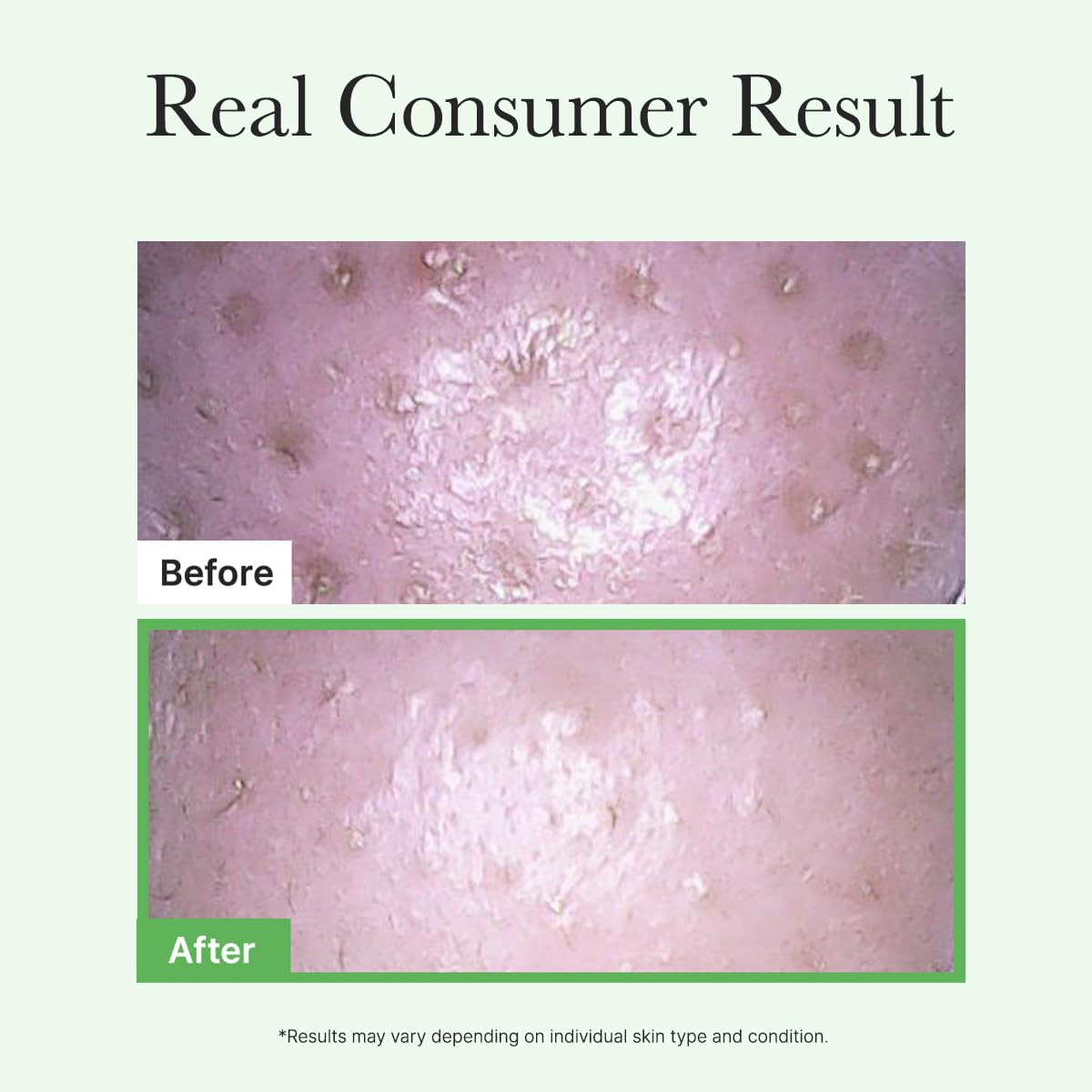 Pore Melt Mochi Cleansing Oil - Зображення 2