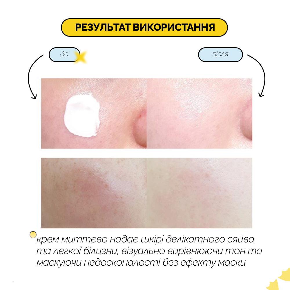 Niathione Cream - Зображення 3